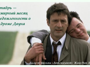 синдром Дауна