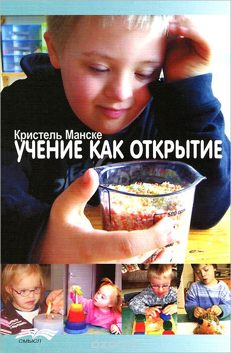 Синдром Дауна
